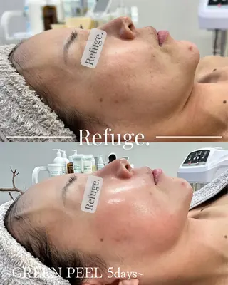 グリーンピール専門サロン Refuge.所属・Refuge. (リフュージュ)のエステ・リラクイメージ