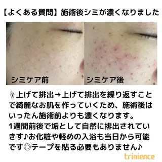 シミケア・肌改善専門 トリニエンス浦和店のエステ・リラクイメージ