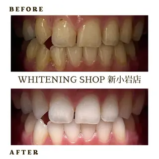 メンズ ホワイトニング ショップ新小岩店のその他イメージ