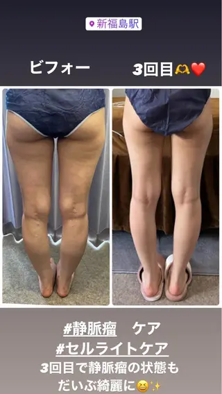 FLEUR大阪・整体 ・ハイフ・痩身・小顔のエステ・リラクイメージ