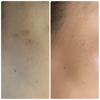 バストアップ専門/ ボディケア/小顔のエステ・リラクイメージ