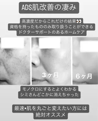 private salon  Dea_maris シュガーリング＆パーソナルボディケア所属・シミ改善・韓国肌管理 ボディメイク痩身のその他イメージ