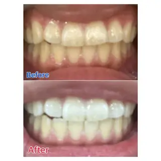 MBEAUTYSALON 千葉店・京成大久保所属・Melty 輝のその他イメージ