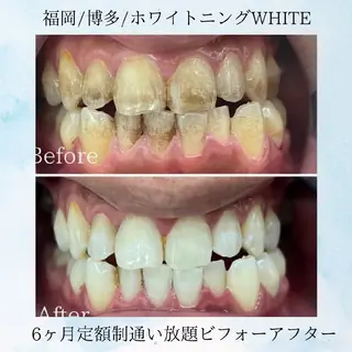 ホワイトニングサロン WHITE福岡博多店のエステ・リラクイメージ