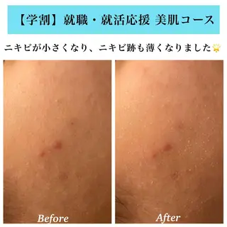 Bellesthe (ベルエステ)のエステ・リラクイメージ