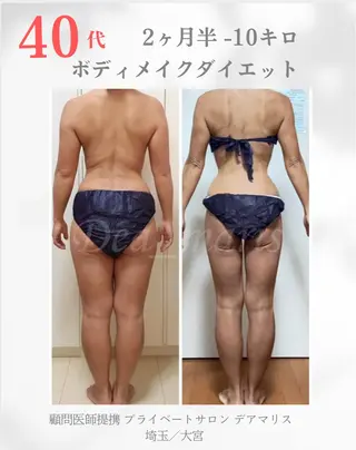 private salon  Dea_maris シュガーリング＆パーソナルボディケア所属・ダイエット難民が通う 10キロダイエットのその他イメージ