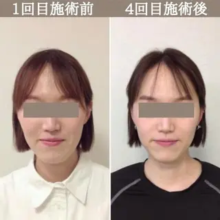 Looom 田中里奈のその他イメージ