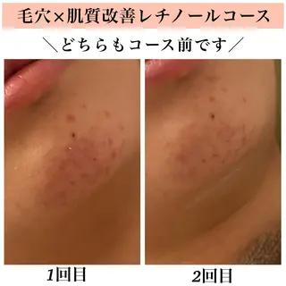 Bellesthe (ベルエステ)のエステ・リラクイメージ