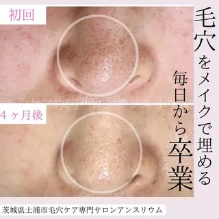 毛穴ケア専門サロンアンスリウム所属・茨城土浦 つくば毛穴 ケア専門サロンのエステ・リラクイメージ