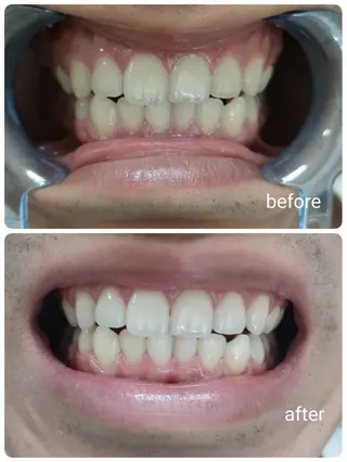 エクシアホワイトニング西条店所属・エクシア ホワイトニング西条店のその他イメージ