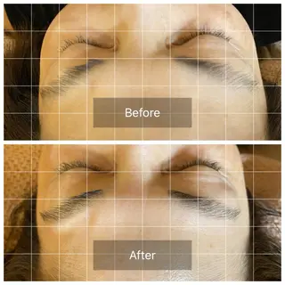 アイブロウ グリーンピール専門 ローマピンクTAMAのエステ・リラクイメージ