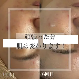 WHITE AQUA 北千住店のエステ・リラクイメージ