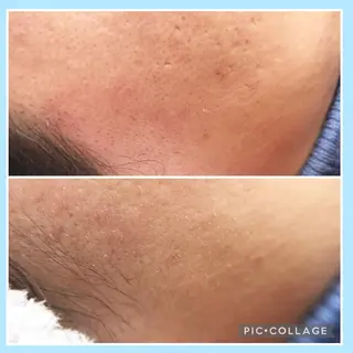 L’oeillet所属・🌊🌊__ juna__のマツエク・マツパデザイン