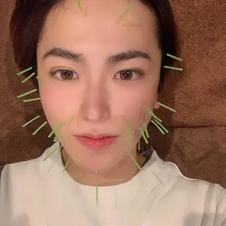 美容鍼灸サロン LOMIHARIのエステ・リラクイメージ