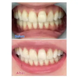 M渋谷店所属・M渋谷 ホワイトニングのエステ・リラクイメージ