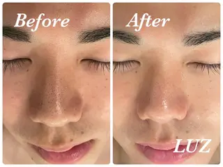 メンズ メンズフェイシャル アイブロウ・ルースのエステ・リラクイメージ