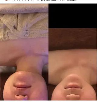 小顔コルギ&よもぎ蒸しサロンLINKA所属・小顔&美肌 サロンLINKAのエステ・リラクイメージ