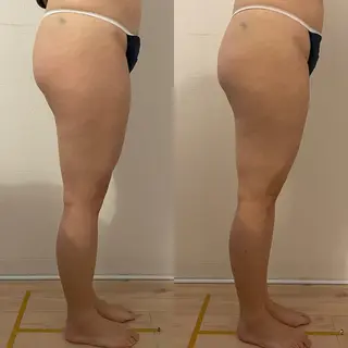 女性のお悩み美容 サロン　ヴィーナスのエステ・リラクイメージ