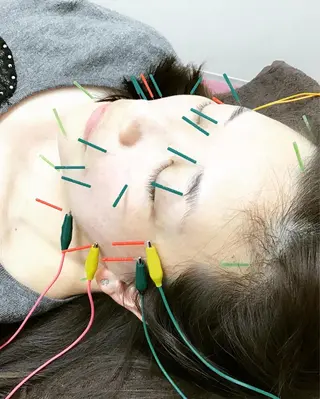 まごころ鍼灸整骨院所属・まごころ鍼灸整骨院 京王堀之内院のエステ・リラクイメージ