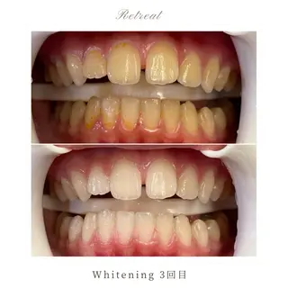 メンズ キッズ Retreatリトリート所属・歯科医院提携 Retreatのその他イメージ