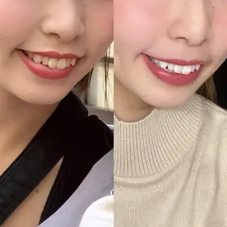 ホワイトニング専門店 LCS 銀座店 峰岡のその他イメージ