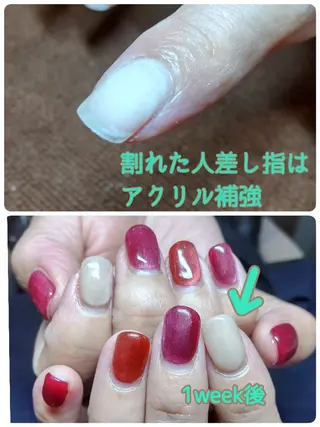 ネイル 深爪矯正/爪育成ケア manie nailのネイルデザイン