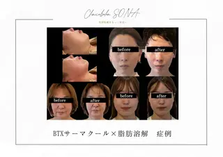 小顔/たるみ/黒ずみ除去専門サロン/SONA 大和西大寺店所属・【小顔専門看護師 サロンSONA】のエステ・リラクイメージ