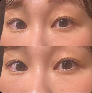 マツエク・マツパ spinner所属・小橋 未夢のマツエク・マツパデザイン