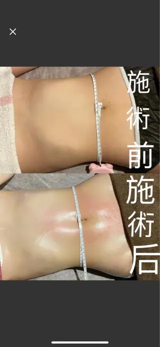 ショート リラクゼーション＆エステランベリー所属・ランベリ ランベリのエステ・リラクイメージ