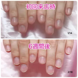 ネイル 深爪を断らない スカルプ高評価店のネイルデザイン