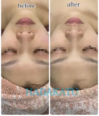 総合エステサロン 肌活のエステ・リラクイメージ