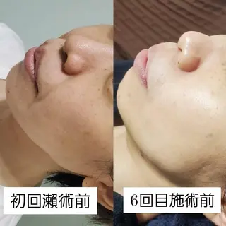 See by merのマツエク・マツパデザイン