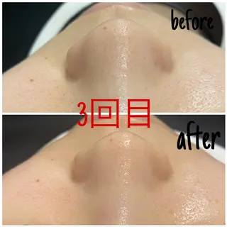 アルカンジュ~archange~所属・痩身/毛穴洗浄/脱毛 アルカンジュのエステ・リラクイメージ