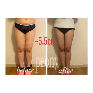 デトックス美容専門サロンpeony所属・デトックス美容専門 サロンpeonyのエステ・リラクイメージ