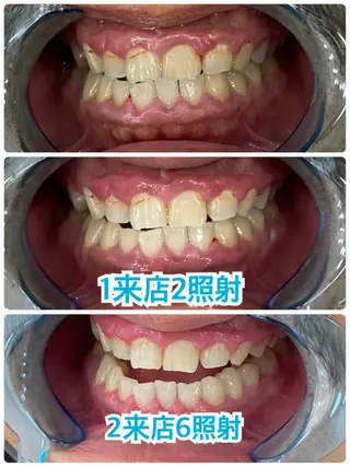 プラチナムビューティー柏所属・【歯科提携】柏ホワイ トニングスタイルのその他イメージ