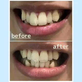 お手軽ホワイトニングsalon mina所属・武元 奈津美のその他イメージ