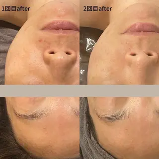 DUPE&MORE所属・DUPE&MORE 店長kanaeのエステ・リラクイメージ