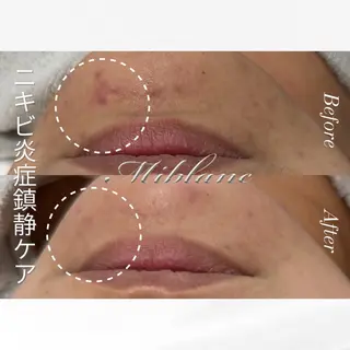 肌質管理 MIBLANC上野店のその他イメージ