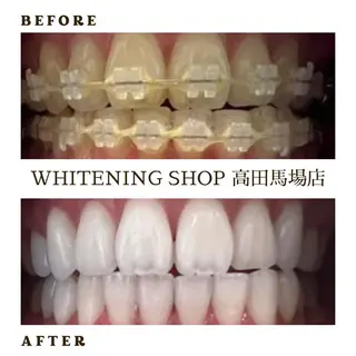 メンズ ホワイトニング ショップ高田馬場店のその他イメージ