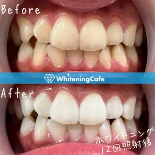 ホワイトニングカフェ神戸元町店所属・ホワイトニングカフェ 神戸元町店のエステ・リラクイメージ