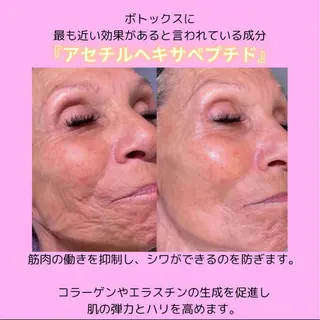 Lily luce 美骨小顔矯正のその他イメージ