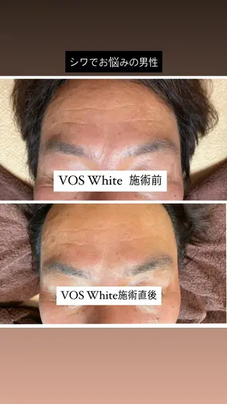 代表 MOMOの眉毛・アイブロウイメージ