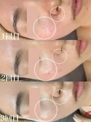 WHITE AQUA 北千住店のエステ・リラクイメージ