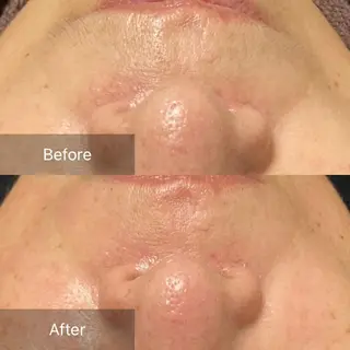 産毛専門店 Bittoのエステ・リラクイメージ