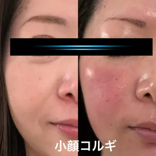 【ハイパーナイフ痩身&小顔コルギ&ハーブピーリング】K-Beauty　東新宿所属・kーbeauty痩身 フェイシャルのエステ・リラクイメージ