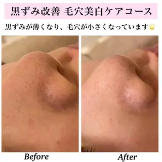 Bellesthe (ベルエステ)のエステ・リラクイメージ