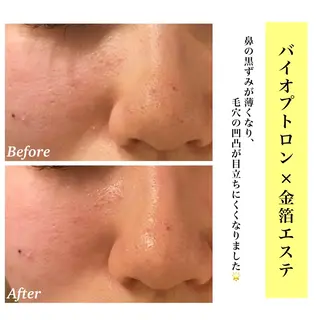 Bellesthe (ベルエステ)のエステ・リラクイメージ