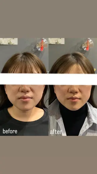 エステサロンino.colore'所属・小顔サロン ino.coloreのエステ・リラクイメージ