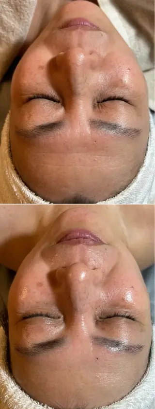 esty hitomiのエステ・リラクイメージ