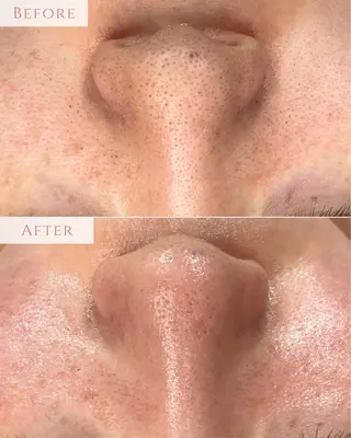 肌質改善専門サロン Bellmi/心斎橋のエステ・リラクイメージ